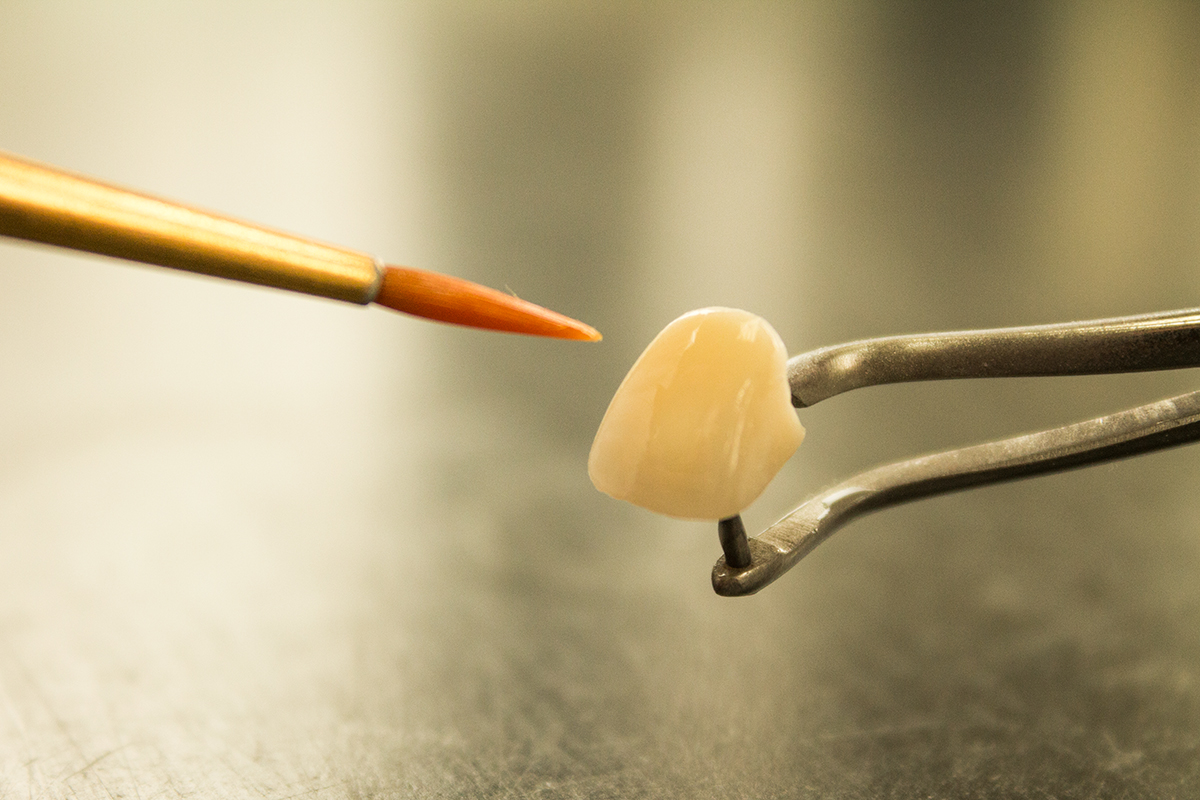 Ontwikkeling-prothese-tand-implantaat-Zoetermeers-Tandtechnisch-Laboratorium-Zoetermeer-tandarts-Zoetermeer-praktijk